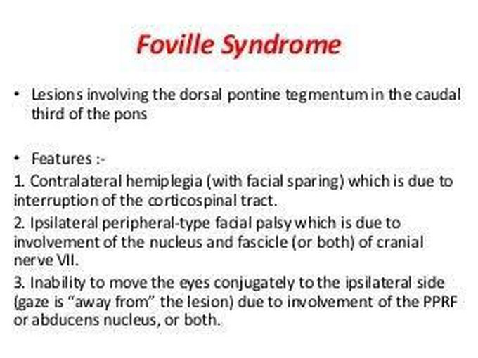 These are features of Foville syndrome