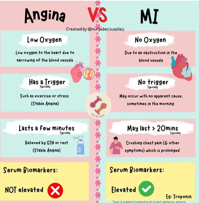 Angina Vs MI