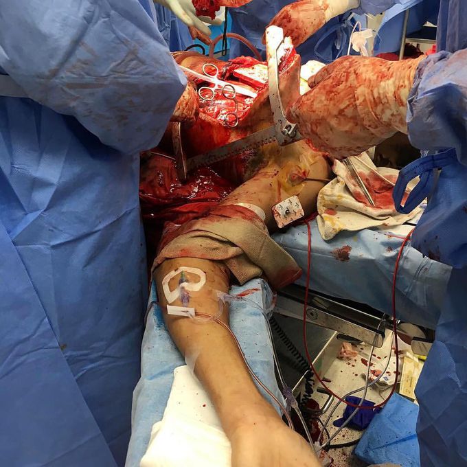 Trauma doctors giving their all to save a life!! 
