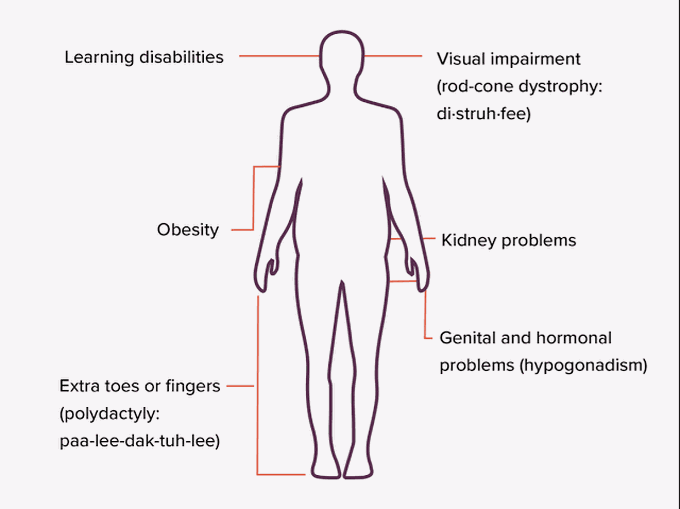 These are the main symptoms of Bardet biedl syndrome