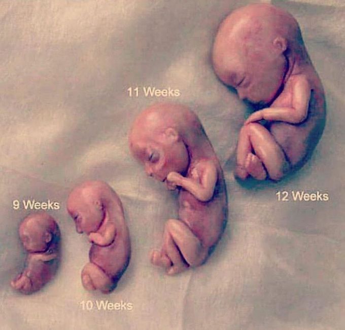 Different stages of fetal developmental