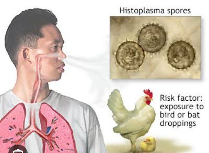 Varieties of Tinea Capitis - MEDizzy