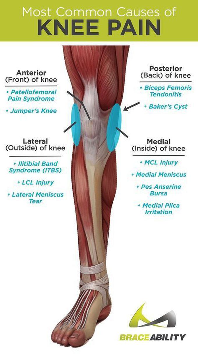 Knee pain