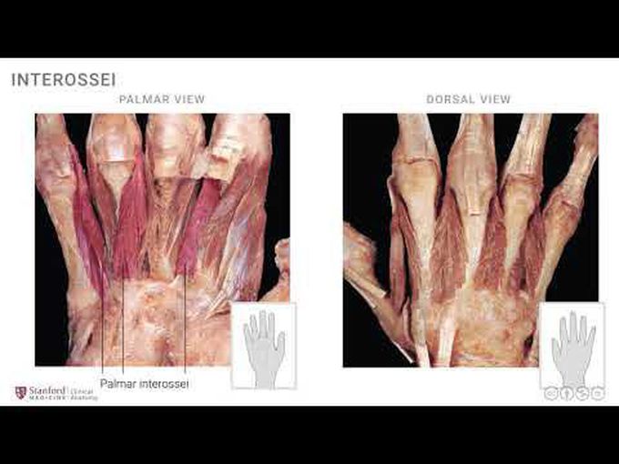 Muscles of the Hand- Interosseous Compartment