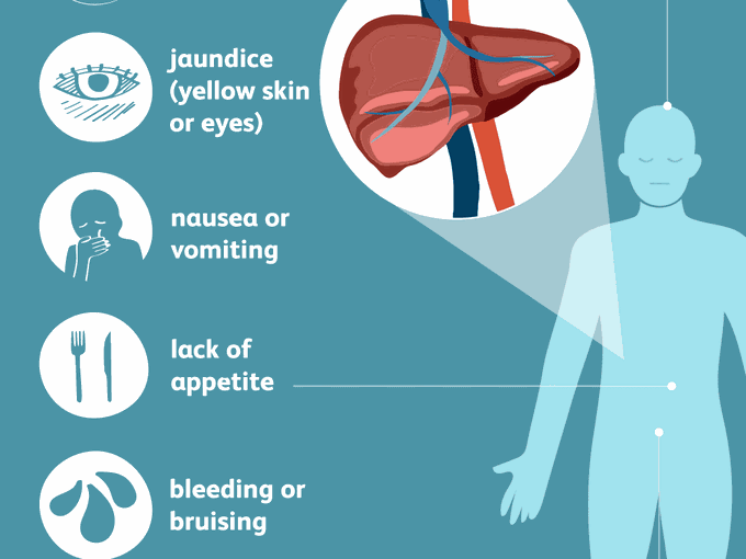 Symptoms of Liver lesions