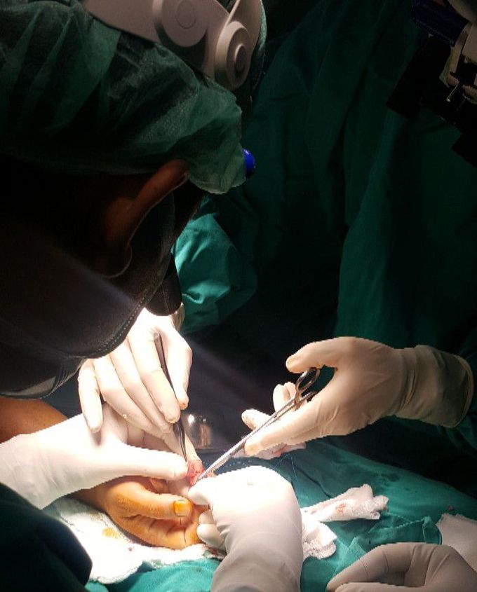 Finger amputation