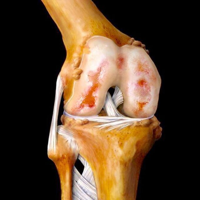 Beautiful artwork of the knee joint! :)