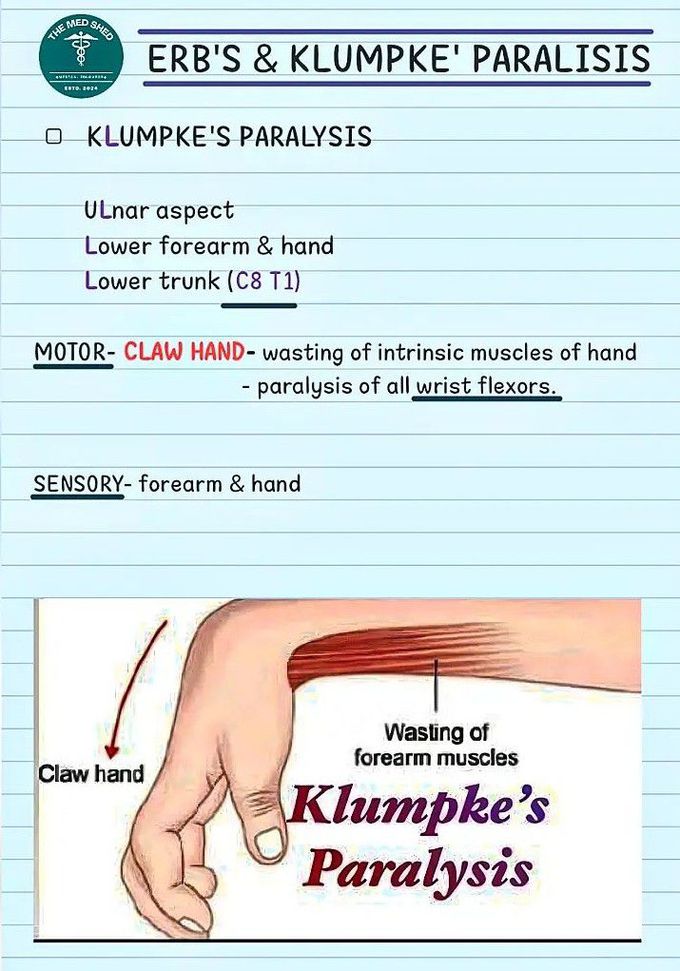 Klumpke's Paralysis