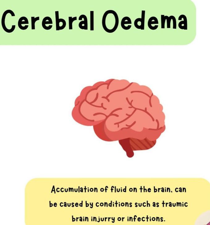 Cerebral Edema