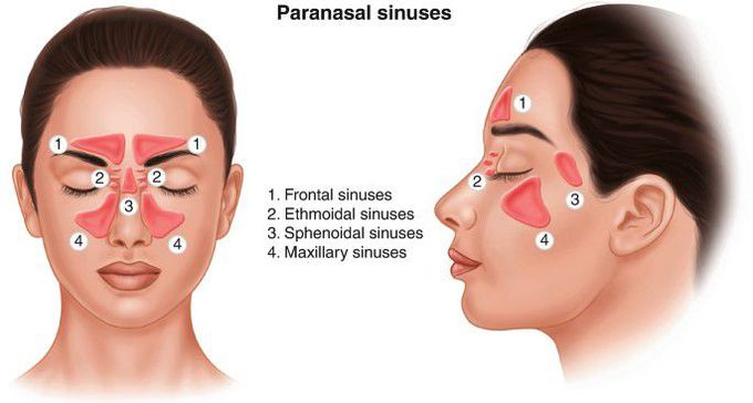 Types of Paranasal Sinuses