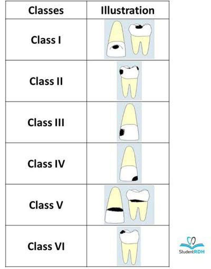 GV black classification