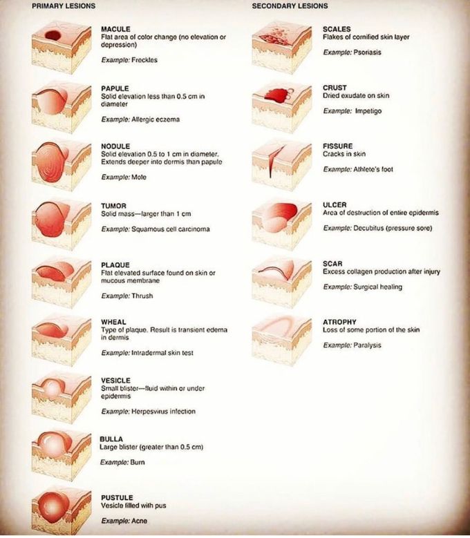 skin lesions chart