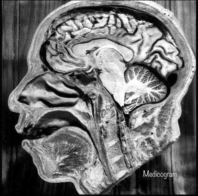 Cross-section of the human head