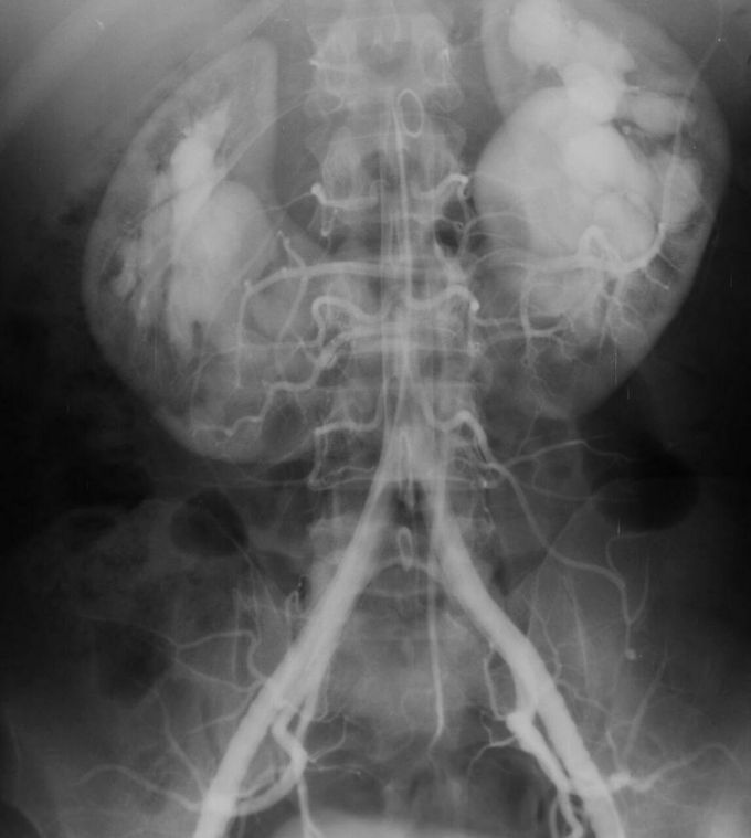 What is your diagnosis