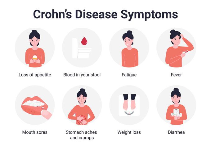 Symptoms of Crohn's disease