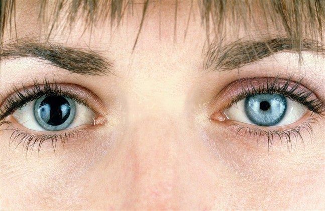 What Can Cause Pinpoint Pupils