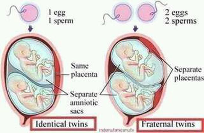 Identical twins and Fraternal  twins