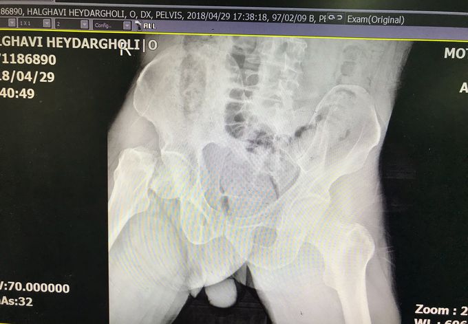 What’s your plan for this patient?!