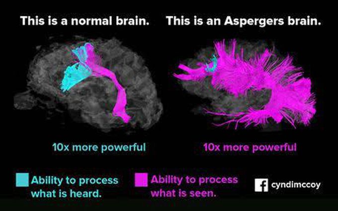 Asperger's syndrome