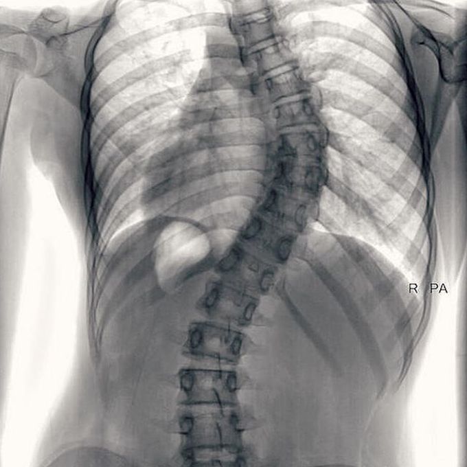 What is your diagnosis? 