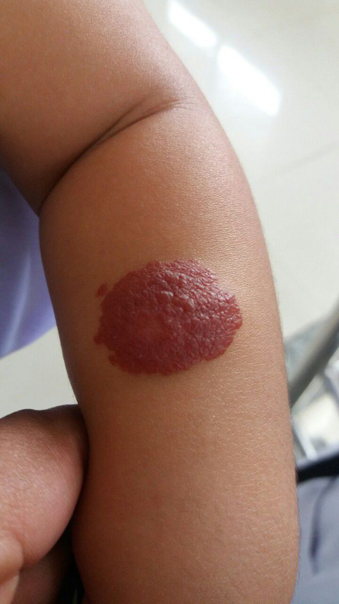 Diagnosis?