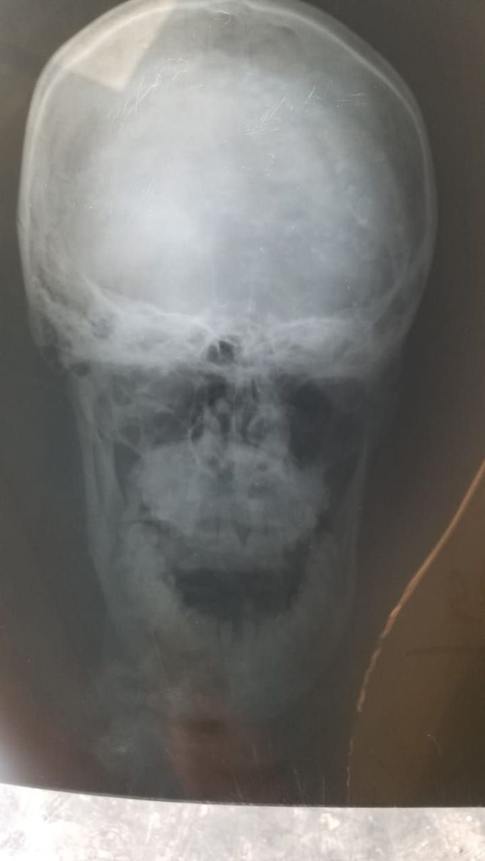 What can be the diagnosis ?