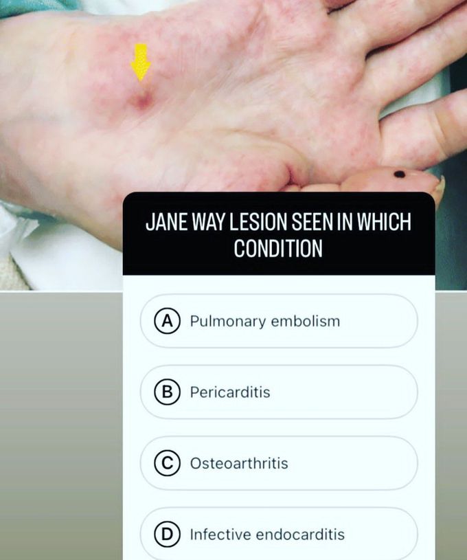 Jane Way Lesion