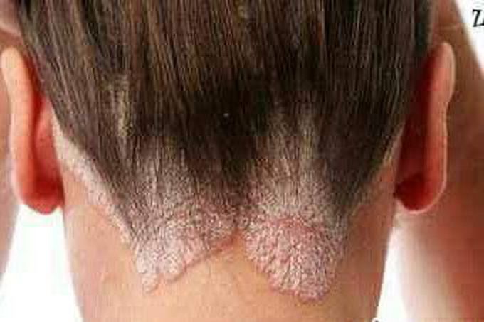 What is diagnosis?