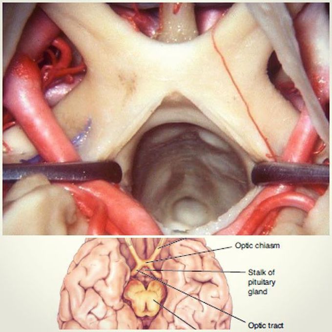 The optic chiasm