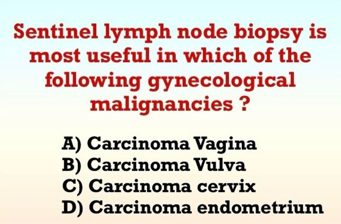 Sentinel Lymph Nodes