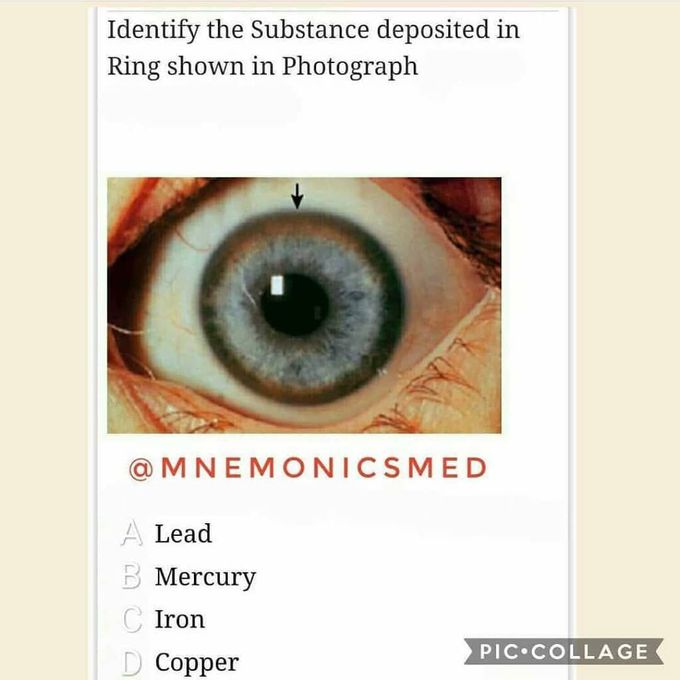 Identify the substance deposited in the eye