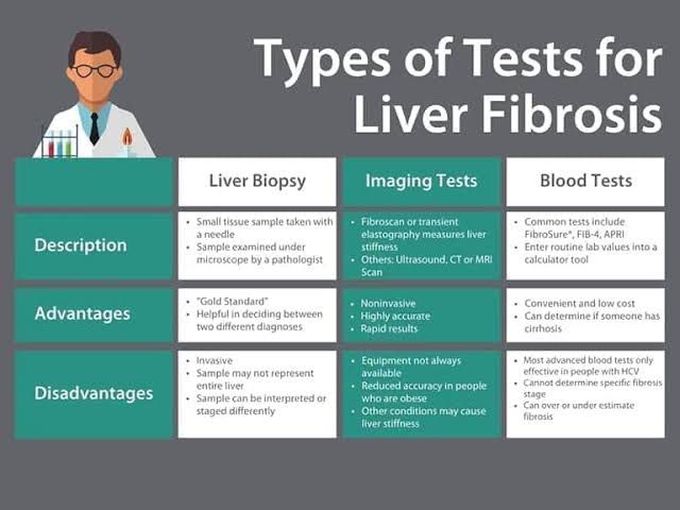 Types of test for liver fibrosis