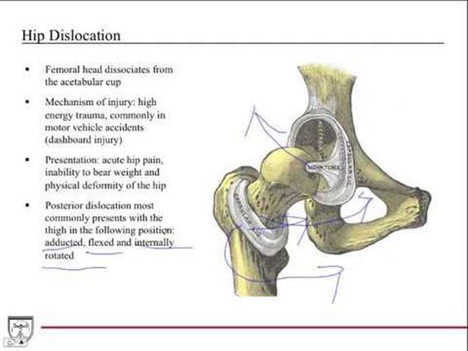In-Depth Review of the Hip Joint