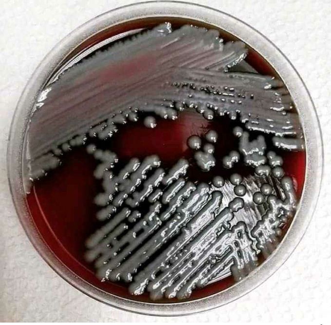 Species of bacteria