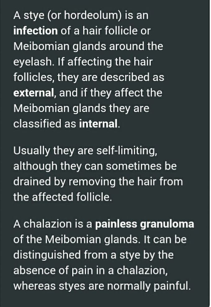 Stye & chalazion