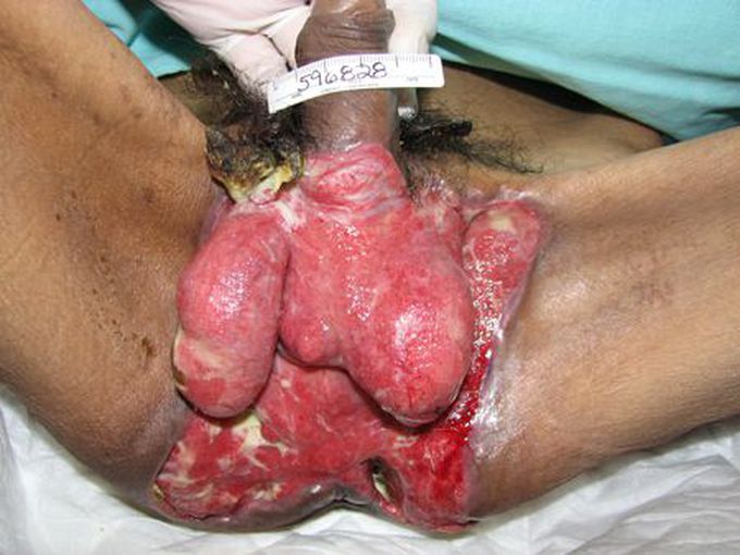Whats your diagnosis?