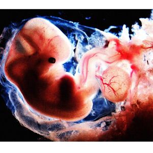 Human embryo at 6 weeks – only a half inch long! - MEDizzy