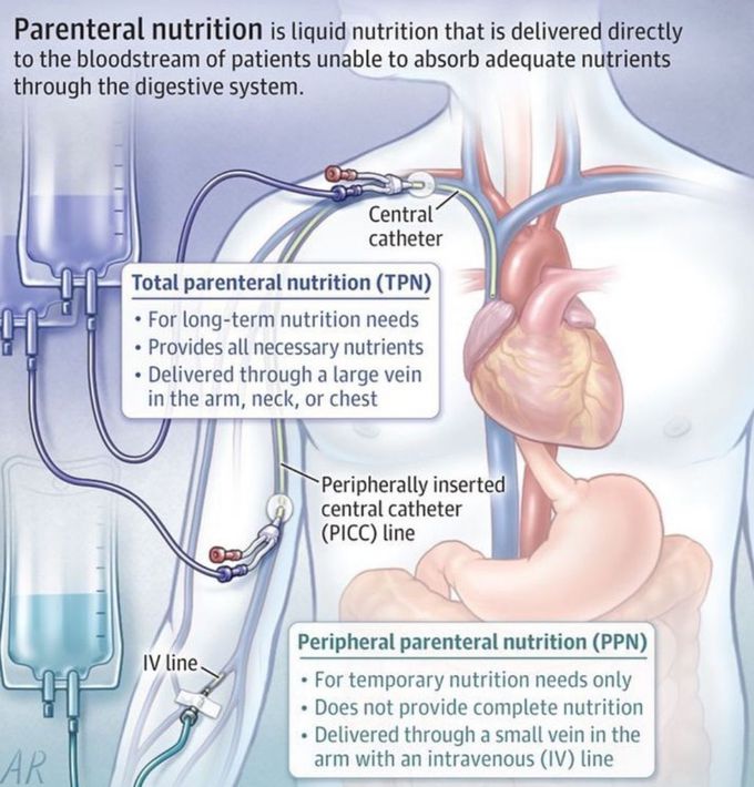 PARENTERAL NUTRITION