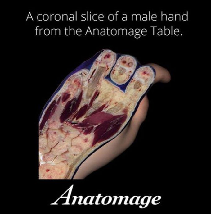 Anatomy