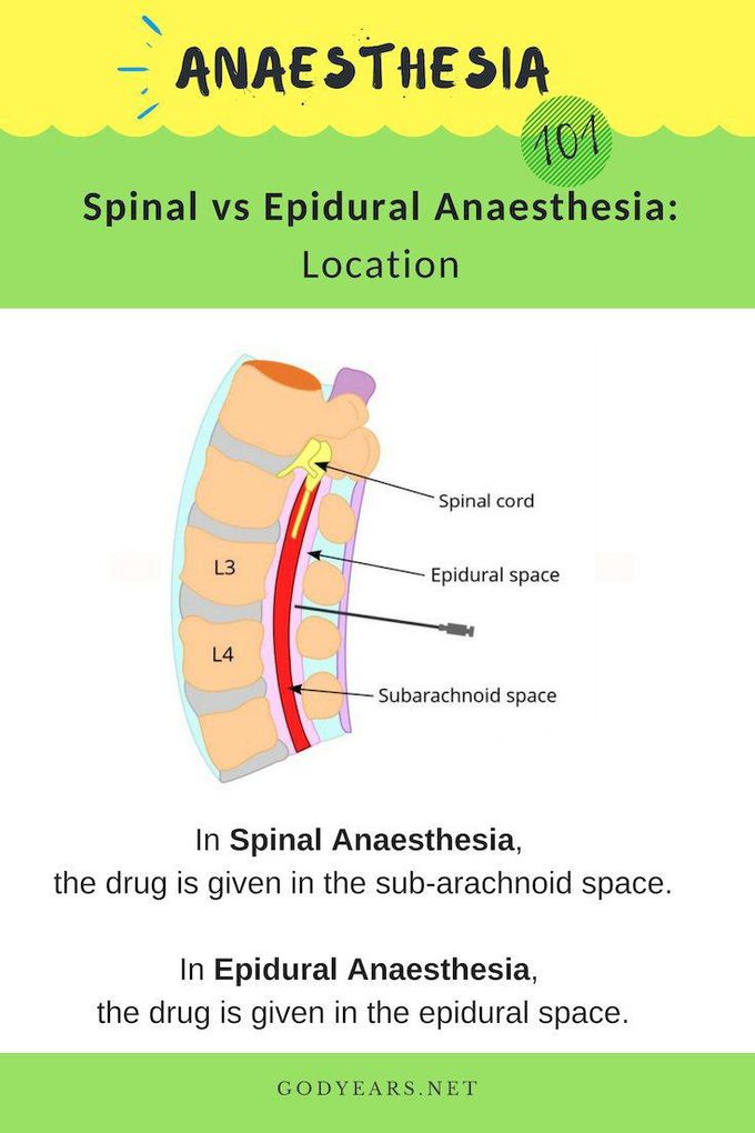 Godyears: Public Awareness: Types of Anaesthesia | Perioperative nursing, Nurse anesthesia, Anesthesia