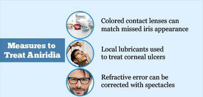 These are the measures to treat Aniridia