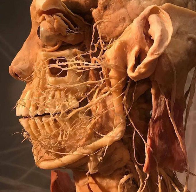 Facial Nerve