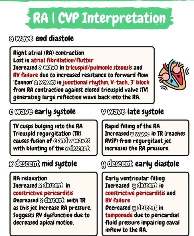 RA CVP Interpretation