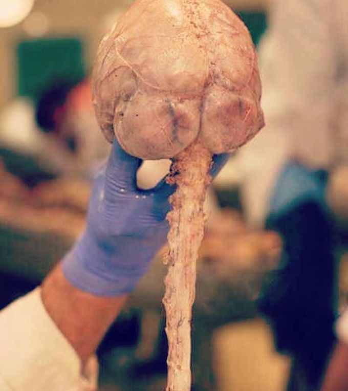 The nervous system