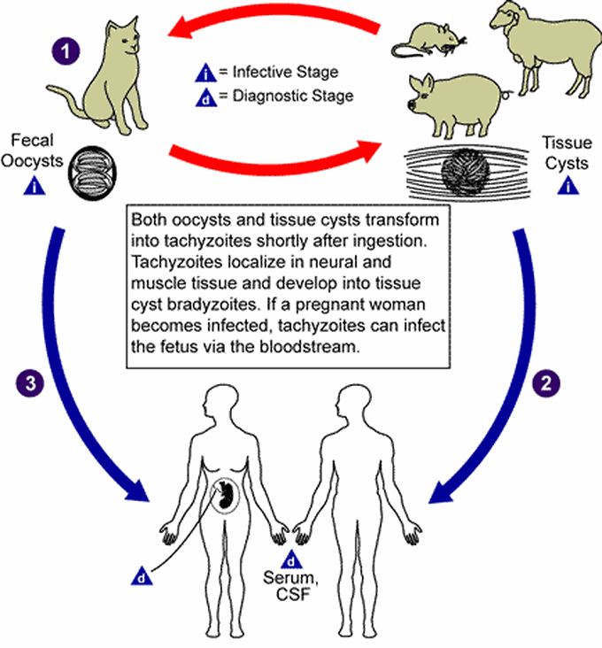 Toxoplasmosis