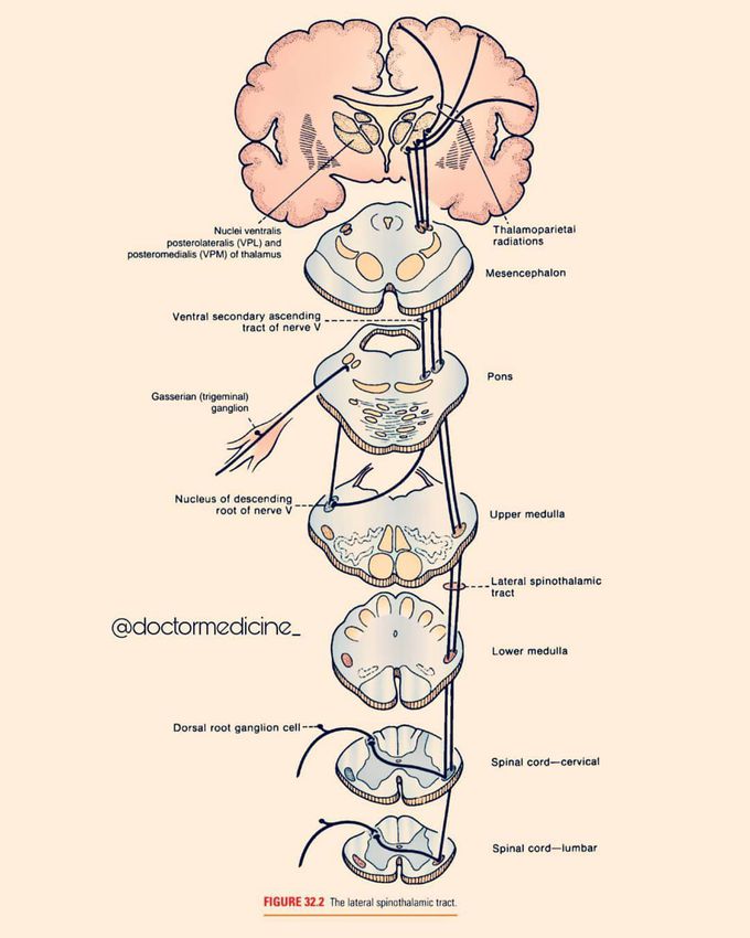 The lateral spinothalmic tract.