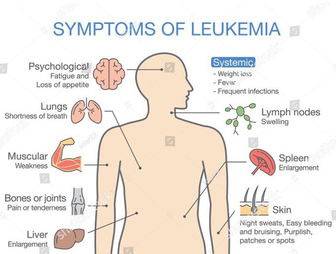 Is petechiae a symptom of leukemia?