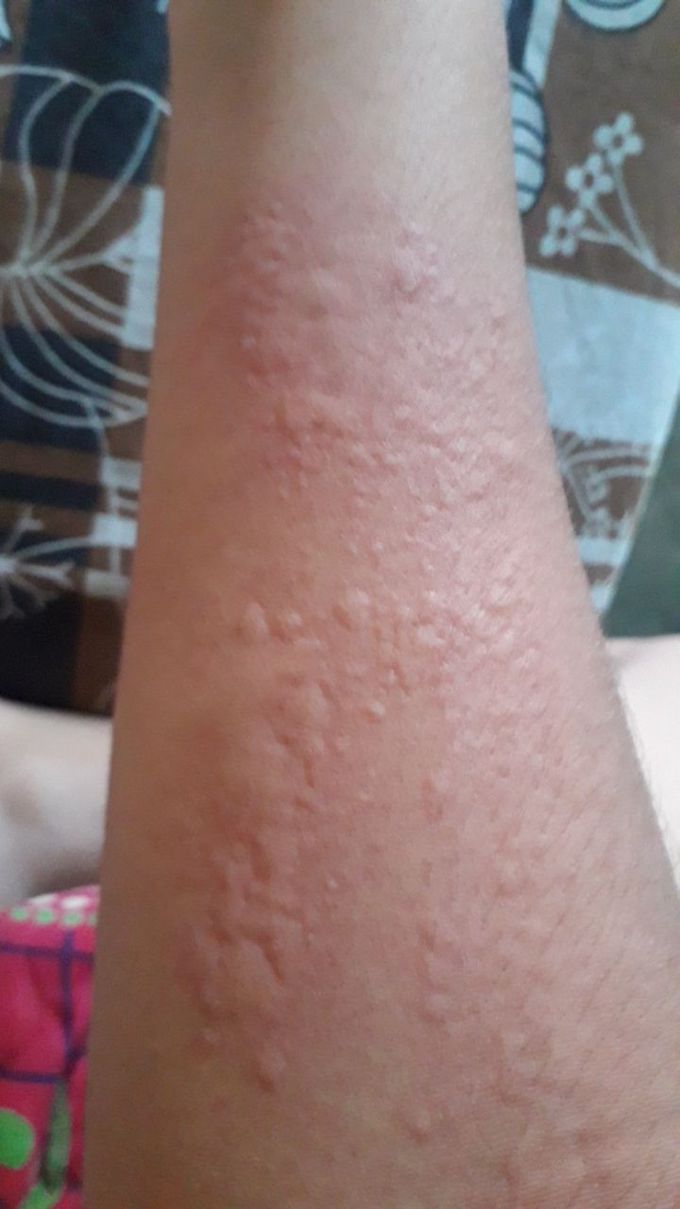 Plz help to Diagnose this symptom?