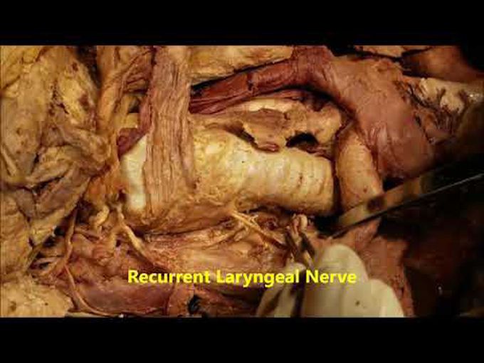 Larynx: A cadaveric dissection