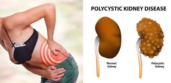 Things we do that damage our kidney